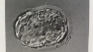 移植した受精卵